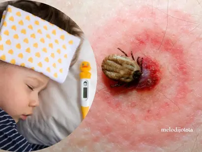 Enfermedad de Lyme en niños: Una guía completa para padres