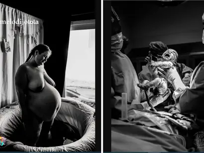 Estas son las mejores fotos de parto y posparto de 2024