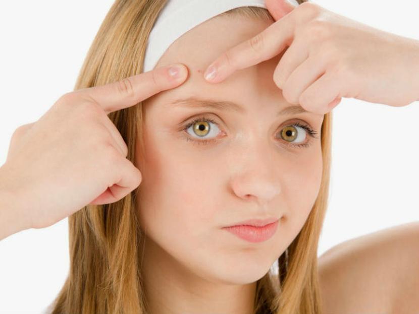 15 consejos infalibles para quitarte el acné, espinillas y granos